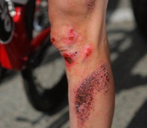 Почему велосипедисты бреют ноги